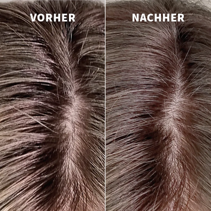 Vorher-Nachher-Ergebnis mit PUR HAIR Dry Foam Shampoo – fettiger Haaransatz wird sichtbar erfrischt und wirkt nach der Anwendung sauber, leicht und gepflegt
